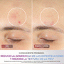 Máscara Facial LED Shark CryoGlow con Enfriamiento
